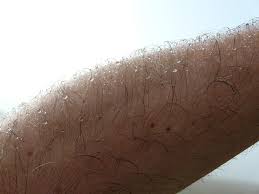 hairy skin